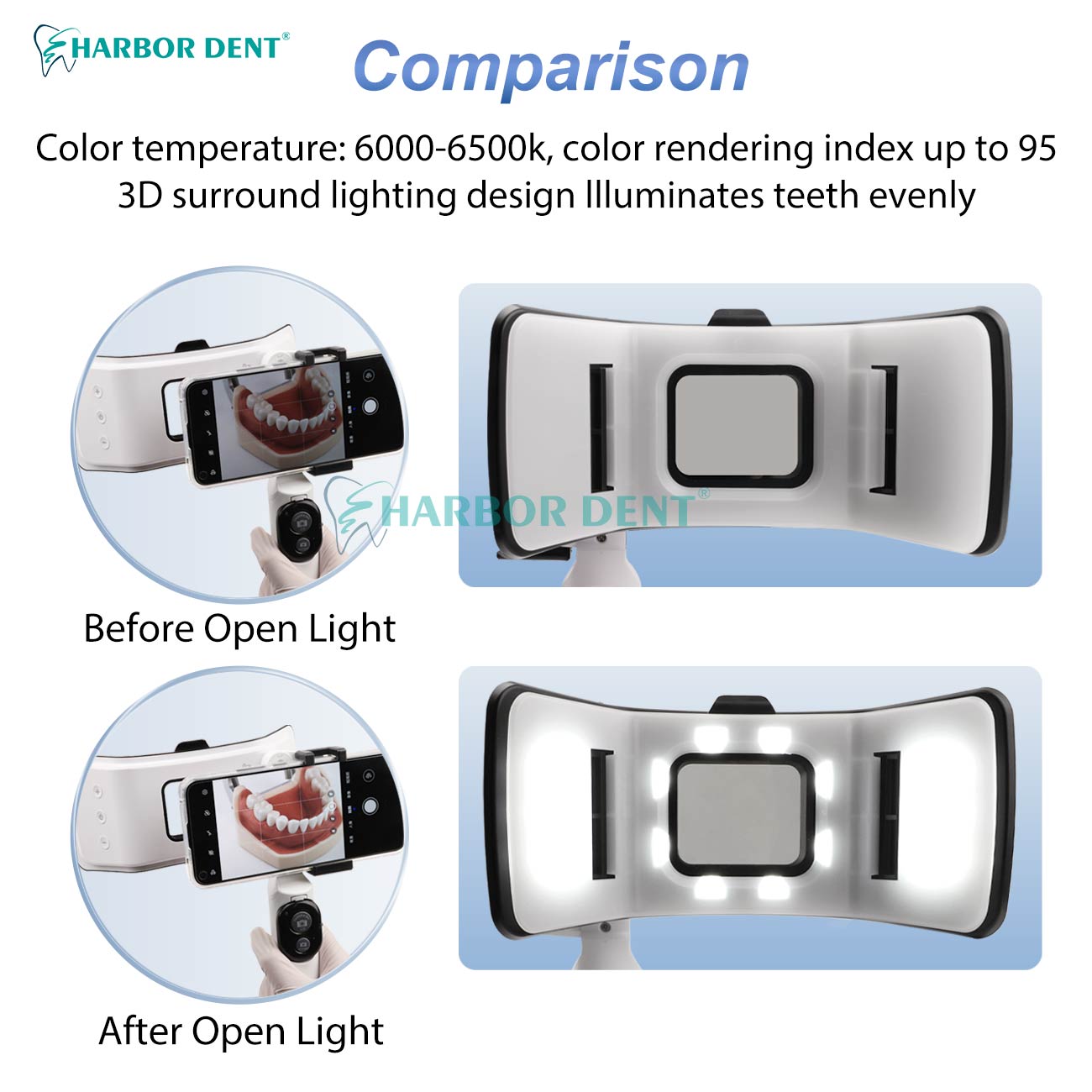 Kit de photographie dentaire à - Good Lighting In Photography avis et prix